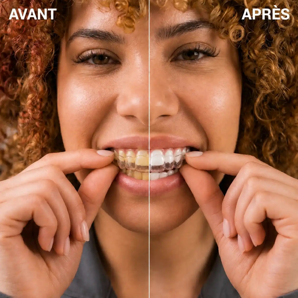 YouvaWave™ — Le nettoyeur à ultrasons spécial gouttières & Invisalign®