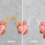 YouvaWave™ — Le nettoyeur à ultrasons spécial gouttières & Invisalign®